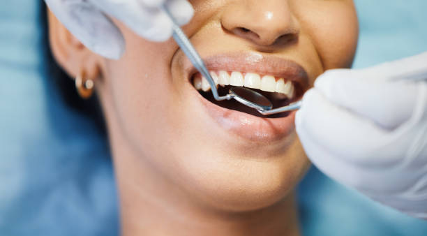 Best Emergency Tooth Extraction in Albany, WI